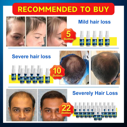 Anti-hair loss Growth Essence Spray