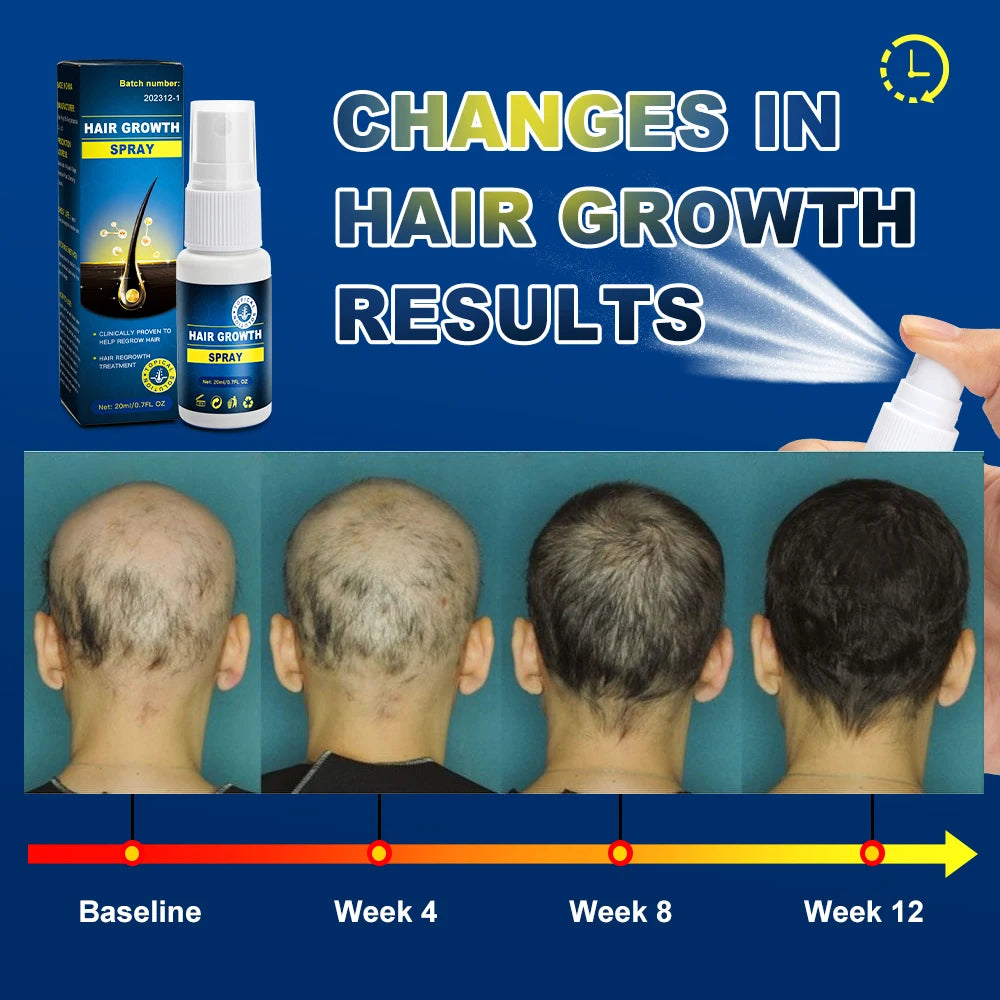 Anti-hair loss Growth Essence Spray