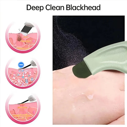 Blackhead Whitehead Removal Tool