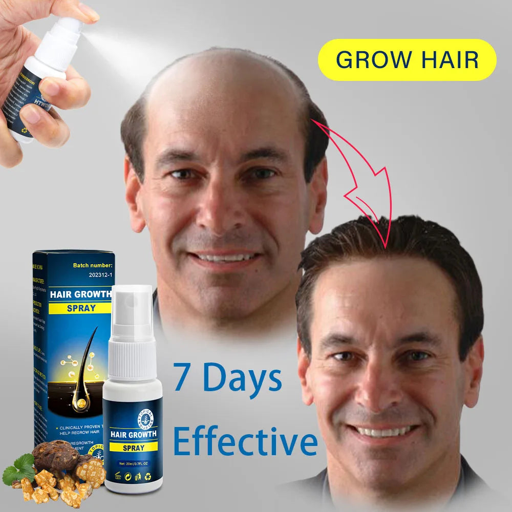 Anti-hair loss Growth Essence Spray