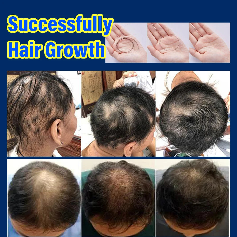 Anti-hair loss Growth Essence Spray