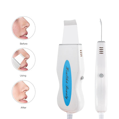 Powerful Ultrasonic Facial Skin Scrubber