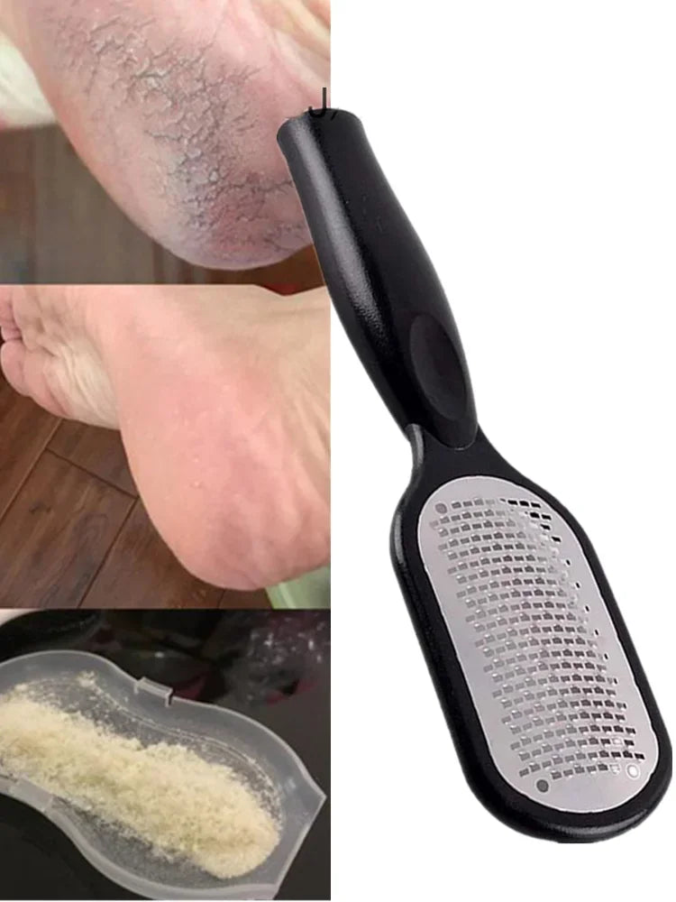 1Pcs Professional Stainless Steel Callus Remover