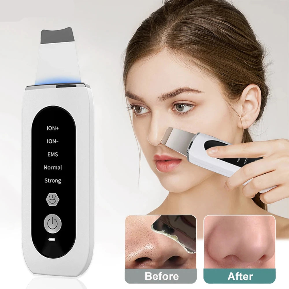 Ultrasonic Face Skin Scrubber